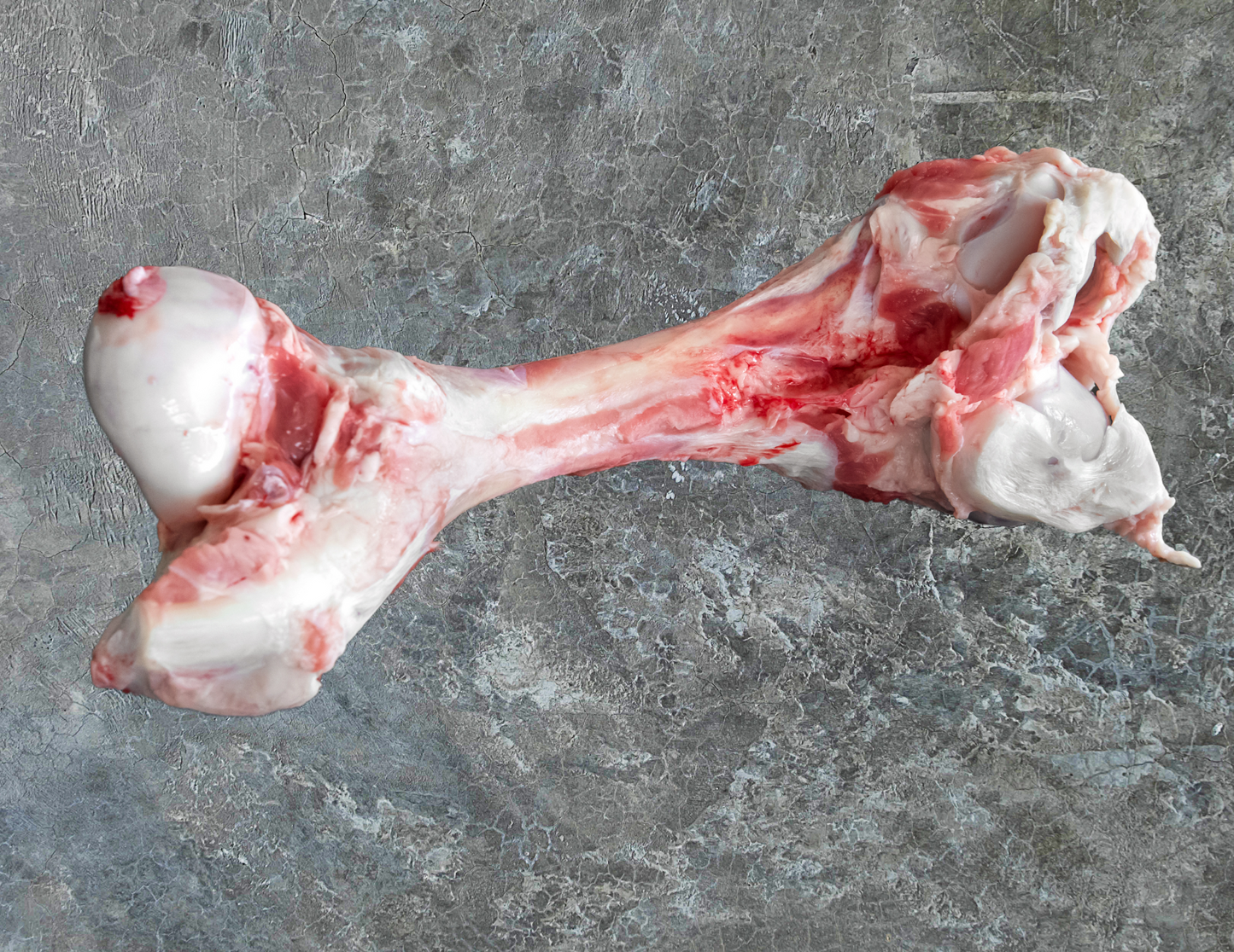 Femur Bone